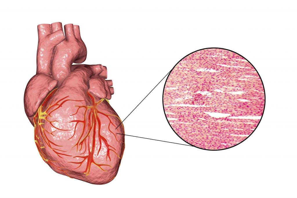 Compresstome References heart organ