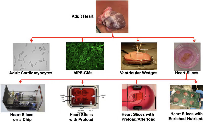 Cardiac slicing