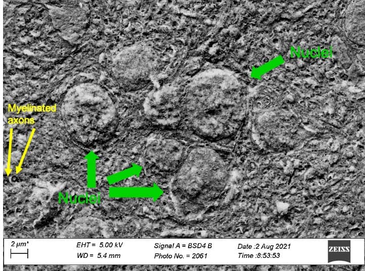 Vibratomes for Electron Microscopy and High-Resolution Imaging