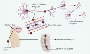 COVID-19 and the Nervous System