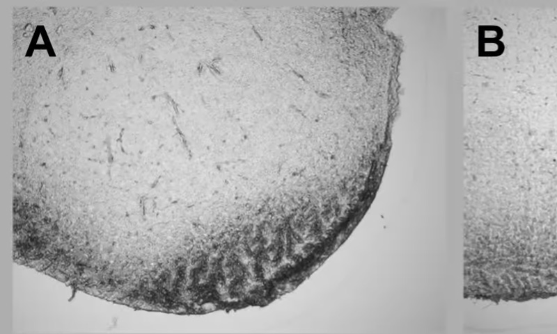 Getting Rid of Tissue Slice Chattermarks
