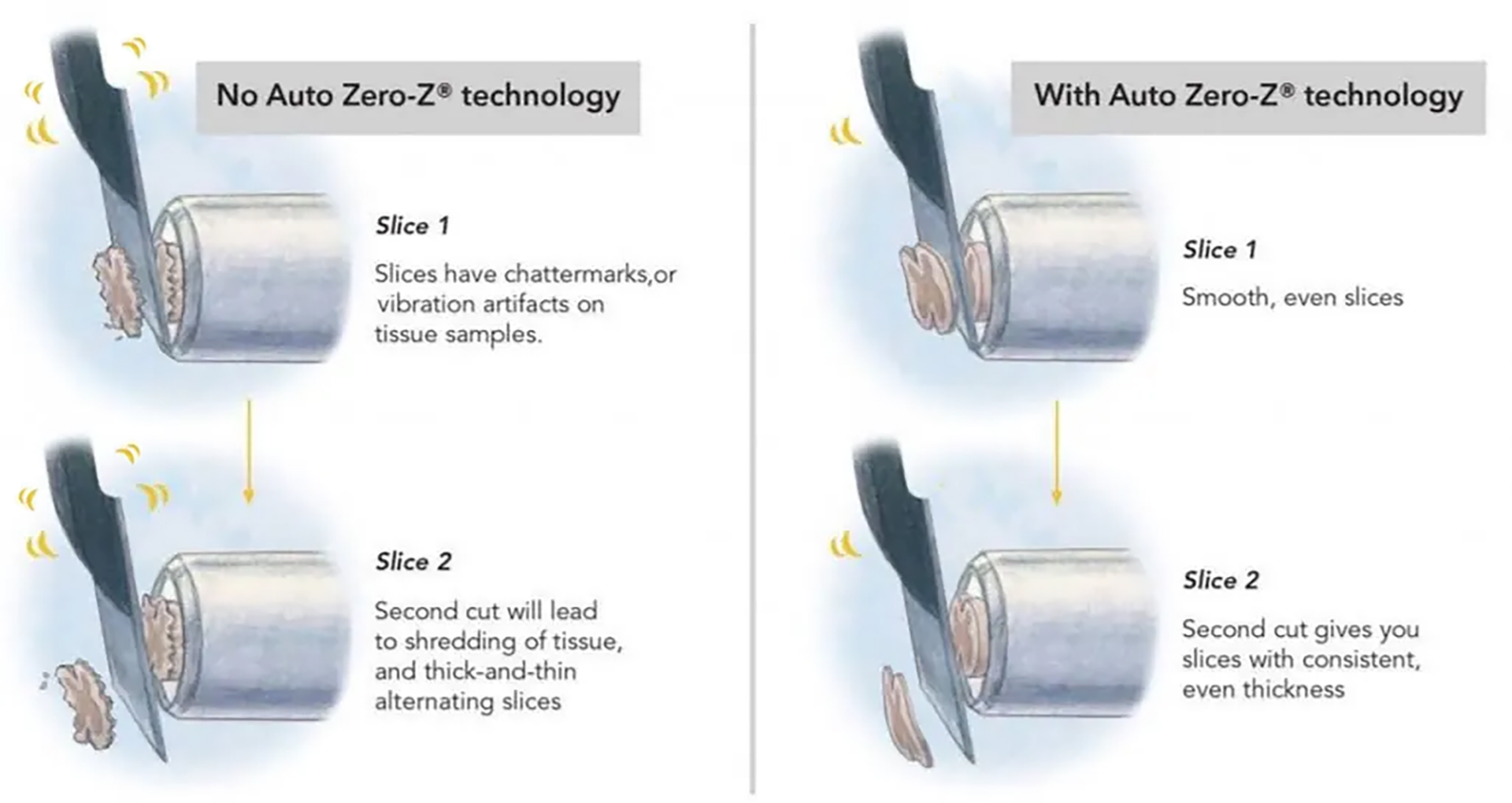 Compression Meams Compresstome® 101 – How It Works & Why It’s Better