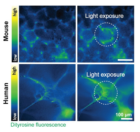 Fluorescent Imaging of Precision-Cut Lung Slices (PCLS