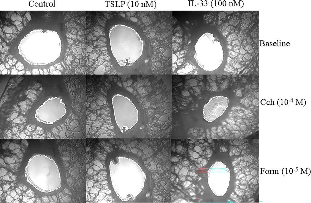 Figure 3. Representative human precision-cut lung slice airway, imaged at baseline, after carbachol-induced contraction, and after formoterol-induced relaxation, across control, TSLP, and IL-33 conditions.