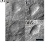 Fig. 2a from Riley et al. Medium spiny neuron somas imaged live in Compresstome-prepared acute tail striatum slices at 40x magnification.