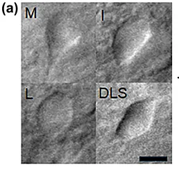 Fig. 2a from Riley et al. Medium spiny neuron somas imaged live in Compresstome-prepared acute tail striatum slices at 40x magnification.